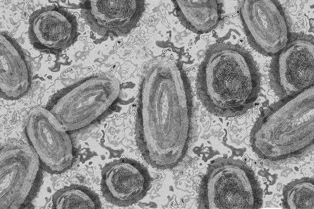 Viruela del mono: lo que necesitas saber sobre esta enfermedad